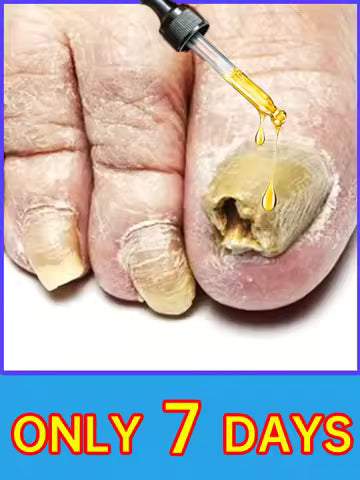 2 IN 1 Auto Micro Skin Tag Remover Device Standard And Micro Skin Tag Removal Kit Adult Mole Wart Remover Face Care Beauty Tools